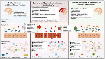 The Microbiome and Alzheimer’s Disease: Potential and Limitations of Prebiotic, Synbiotic, and Probiotic Formulations